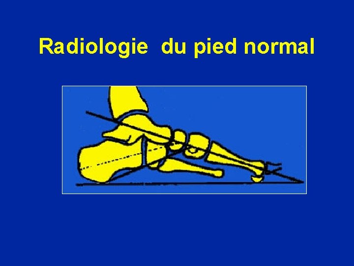 Radiologie du pied normal 