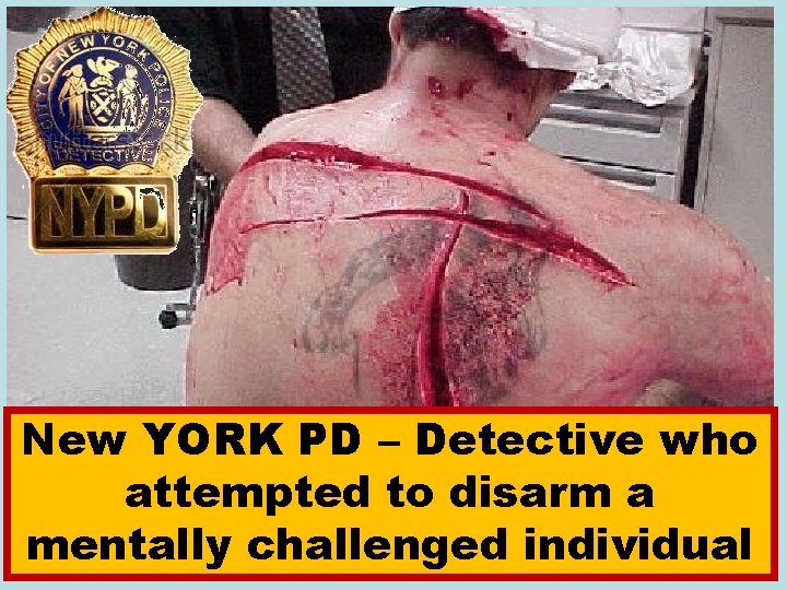New YORK PD – Detective who attempted to disarm a mentally challenged individual 