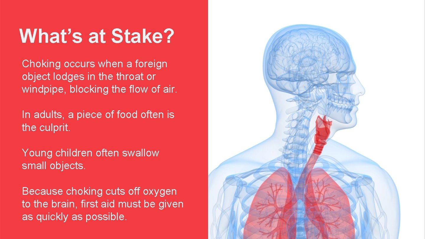 What’s at Stake? Choking occurs when a foreign object lodges in the throat or