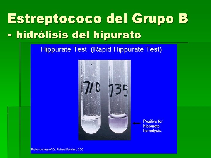 Estreptococo del Grupo B - hidrólisis del hipurato 