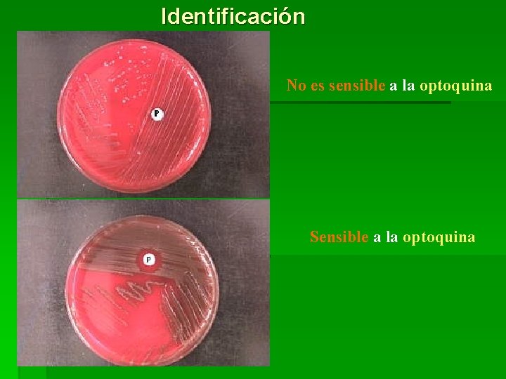 Identificación No es sensible a la optoquina Sensible a la optoquina 