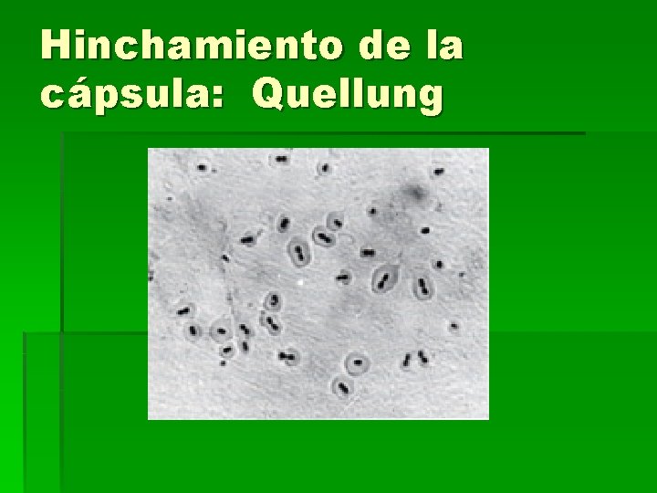 Hinchamiento de la cápsula: Quellung 