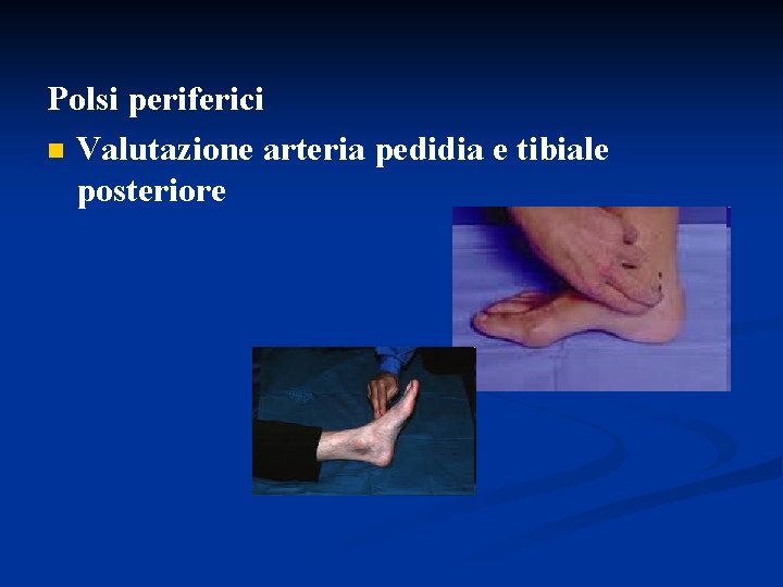 Polsi periferici n Valutazione arteria pedidia e tibiale posteriore Polsi periferici n Valutazione arteria pedidia e tibiale posteriore