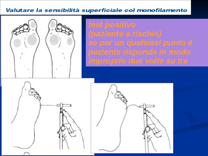 test positivo (paziente a rischio) se per un qualsiasi punto il paziente risponde in test positivo (paziente a rischio) se per un qualsiasi punto il paziente risponde in