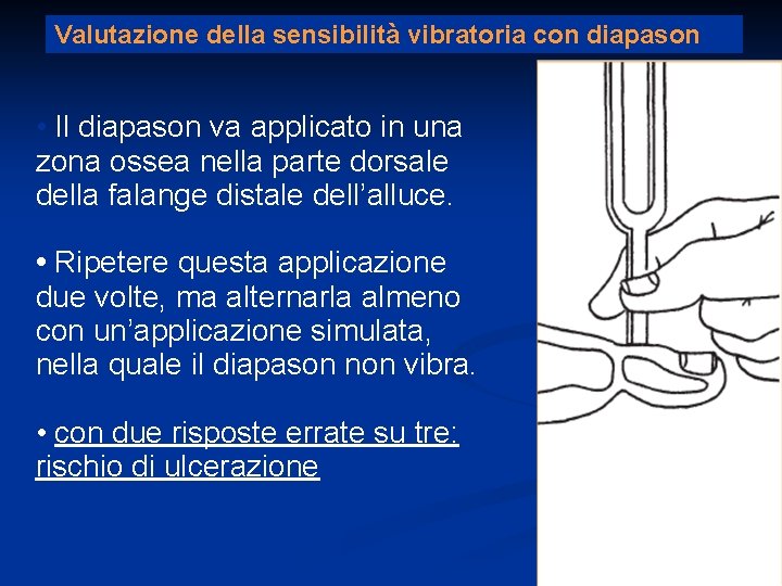 Valutazione della sensibilità vibratoria con diapason • Il diapason va applicato in una zona Valutazione della sensibilità vibratoria con diapason • Il diapason va applicato in una zona