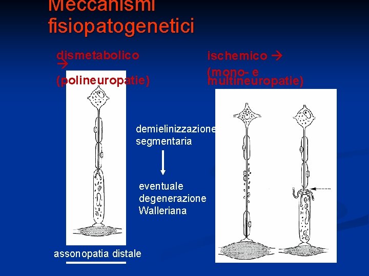Meccanismi fisiopatogenetici dismetabolico (polineuropatie) ischemico (mono- e multineuropatie) demielinizzazione segmentaria eventuale degenerazione Walleriana assonopatia Meccanismi fisiopatogenetici dismetabolico (polineuropatie) ischemico (mono- e multineuropatie) demielinizzazione segmentaria eventuale degenerazione Walleriana assonopatia