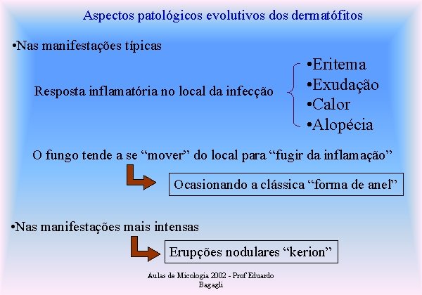Aspectos patológicos evolutivos dermatófitos • Nas manifestações típicas Resposta inflamatória no local da infecção