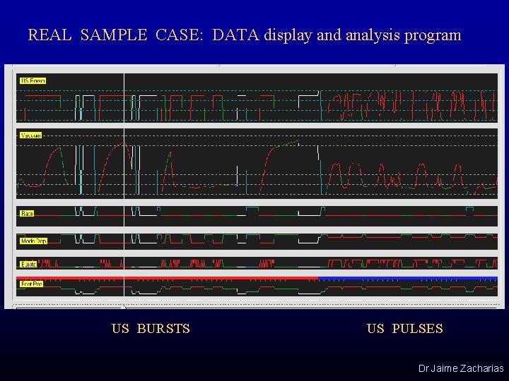 REAL SAMPLE CASE: DATA display and analysis program US BURSTS US PULSES Dr Jaime