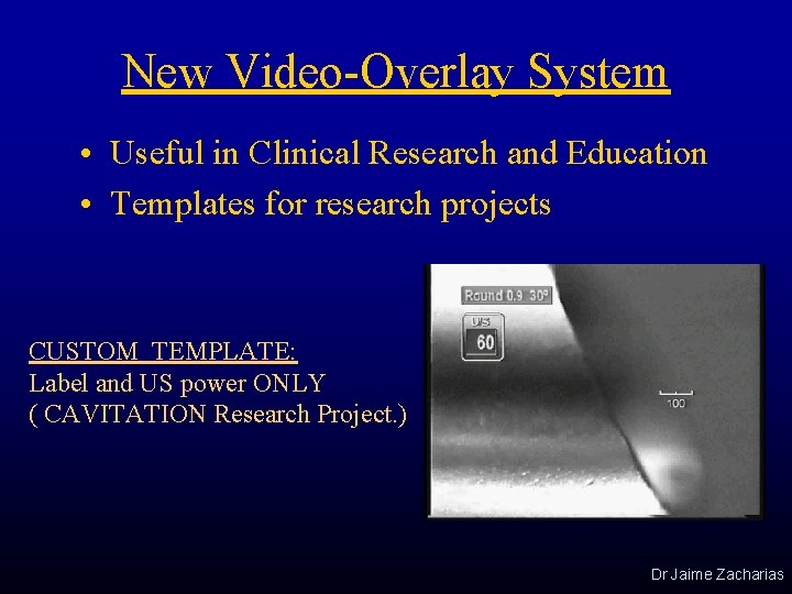 New Video-Overlay System • Useful in Clinical Research and Education • Templates for research