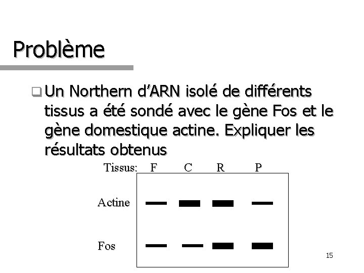 Problème q Un Northern d’ARN isolé de différents tissus a été sondé avec le