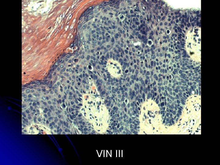 VIN III 