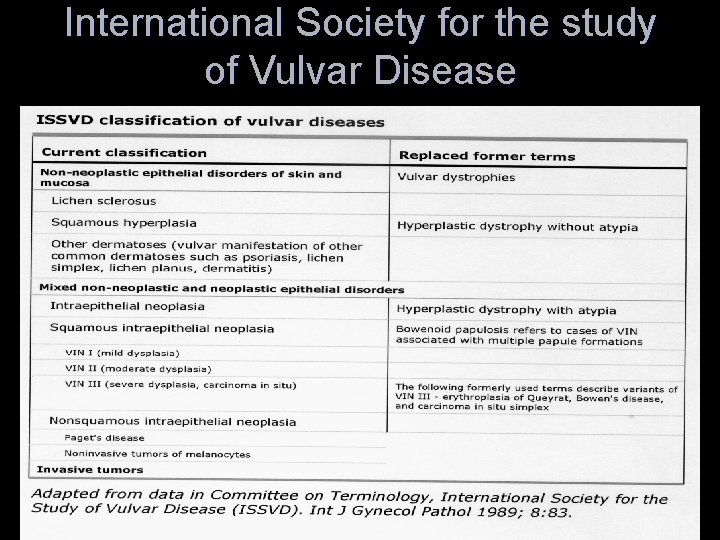 International Society for the study of Vulvar Disease 