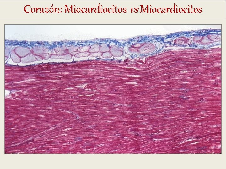 Corazón: Miocardiocitos vs Miocardiocitos Corazón: Miocardiocitos vs Miocardiocitos