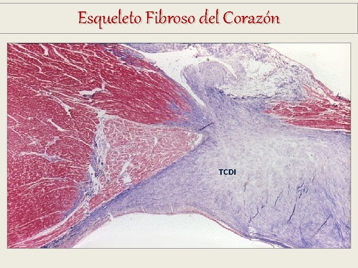 Esqueleto Fibroso del Corazón TCDI Esqueleto Fibroso del Corazón TCDI