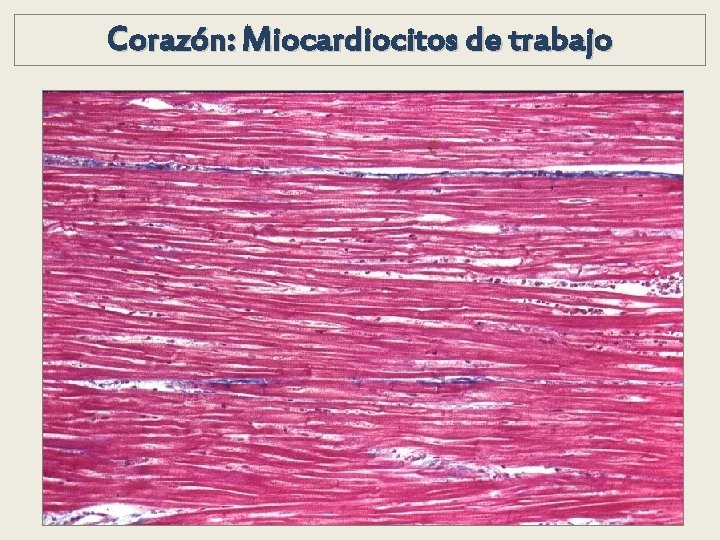Corazón: Miocardiocitos de trabajo Corazón: Miocardiocitos de trabajo