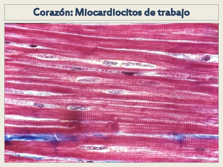 Corazón: Miocardiocitos de trabajo Corazón: Miocardiocitos de trabajo