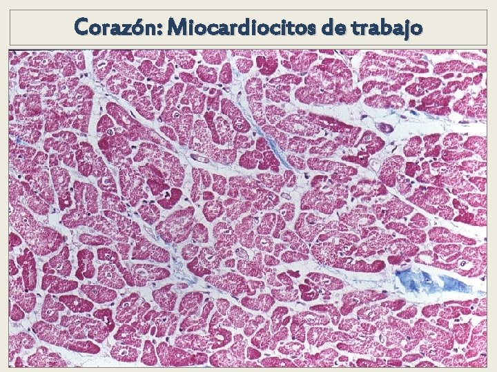 Corazón: Miocardiocitos de trabajo Corazón: Miocardiocitos de trabajo