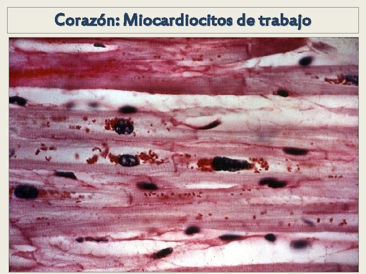 Corazón: Miocardiocitos de trabajo Corazón: Miocardiocitos de trabajo