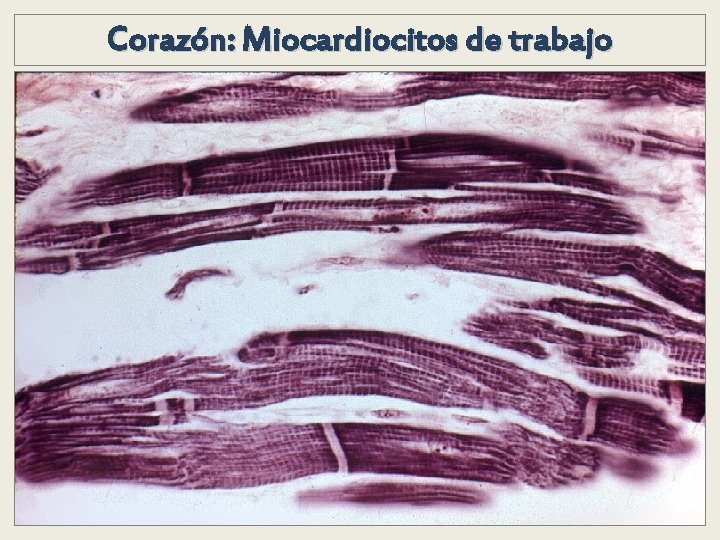 Corazón: Miocardiocitos de trabajo Corazón: Miocardiocitos de trabajo