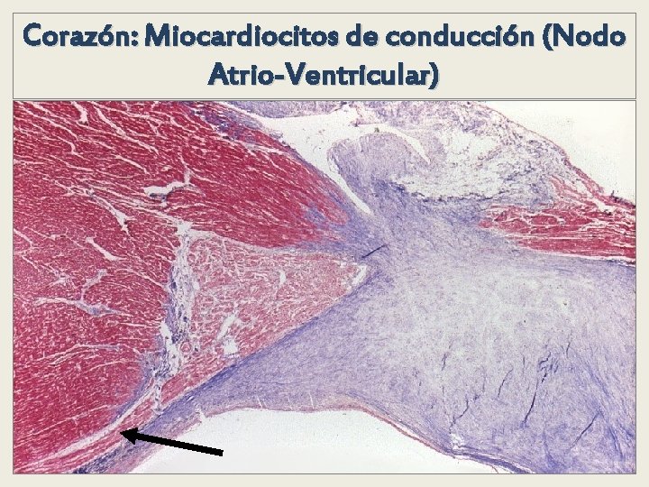 Corazón: Miocardiocitos de conducción (Nodo Atrio-Ventricular) Corazón: Miocardiocitos de conducción (Nodo Atrio-Ventricular)