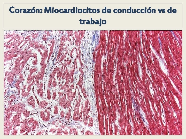 Corazón: Miocardiocitos de conducción vs de trabajo Corazón: Miocardiocitos de conducción vs de trabajo
