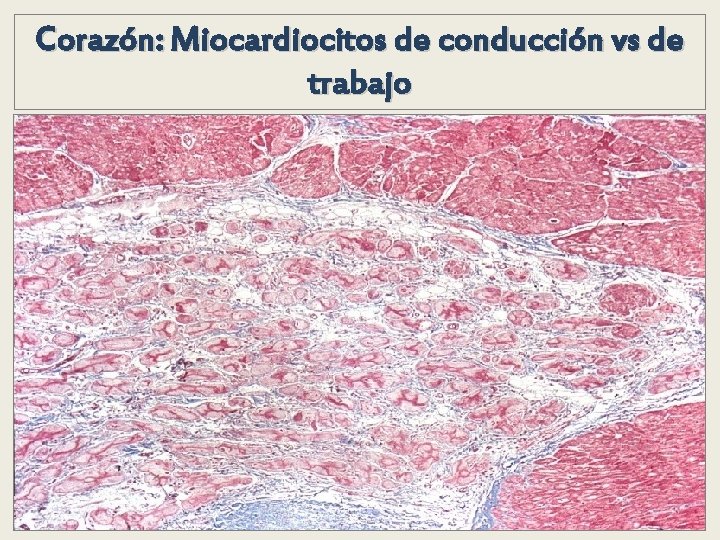 Corazón: Miocardiocitos de conducción vs de trabajo Corazón: Miocardiocitos de conducción vs de trabajo