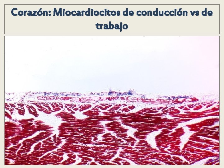 Corazón: Miocardiocitos de conducción vs de trabajo Corazón: Miocardiocitos de conducción vs de trabajo