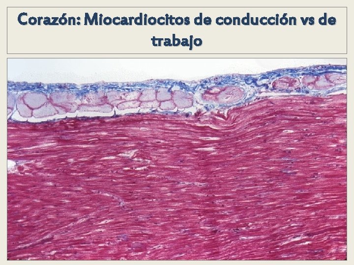 Corazón: Miocardiocitos de conducción vs de trabajo Corazón: Miocardiocitos de conducción vs de trabajo