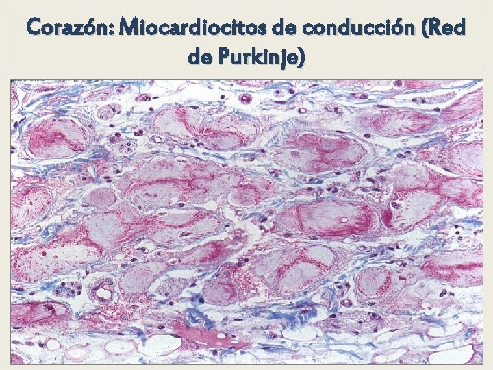 Corazón: Miocardiocitos de conducción (Red de Purkinje) Corazón: Miocardiocitos de conducción (Red de Purkinje)