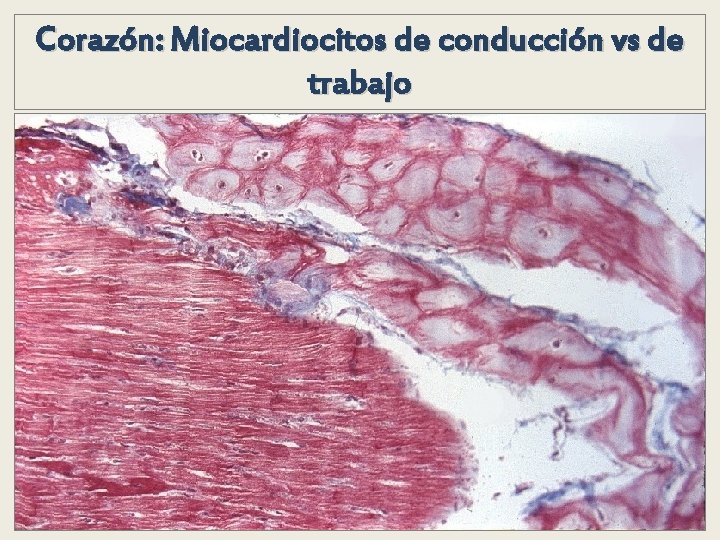Corazón: Miocardiocitos de conducción vs de trabajo Corazón: Miocardiocitos de conducción vs de trabajo