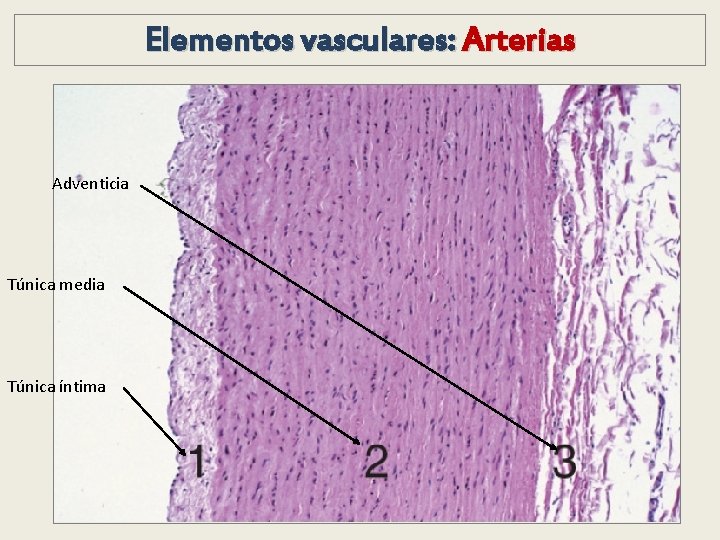 Elementos vasculares: Arterias Adventicia Túnica media Túnica íntima Elementos vasculares: Arterias Adventicia Túnica media Túnica íntima