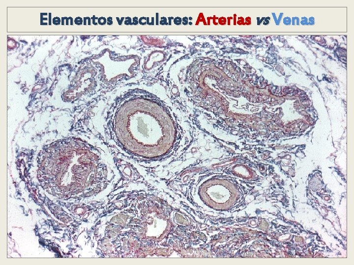Elementos vasculares: Arterias vs Venas Elementos vasculares: Arterias vs Venas