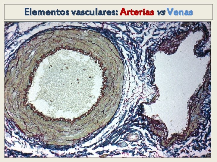 Elementos vasculares: Arterias vs Venas Elementos vasculares: Arterias vs Venas