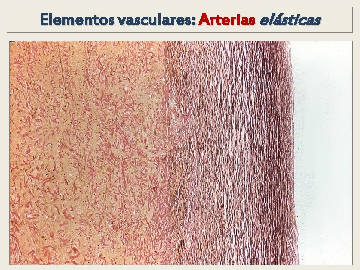 Elementos vasculares: Arterias elásticas Elementos vasculares: Arterias elásticas