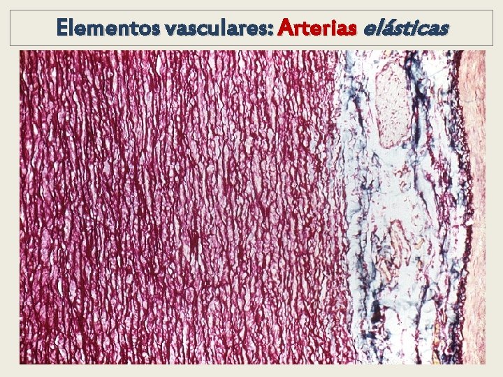 Elementos vasculares: Arterias elásticas Elementos vasculares: Arterias elásticas