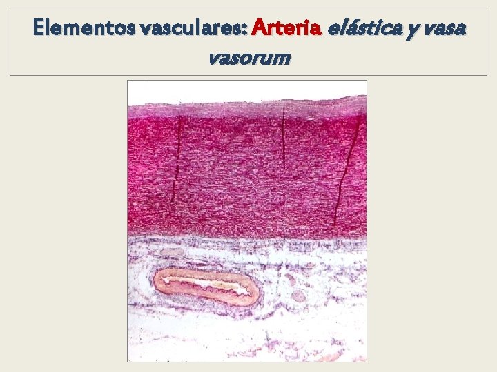 Elementos vasculares: Arteria elástica y vasa vasorum Elementos vasculares: Arteria elástica y vasa vasorum