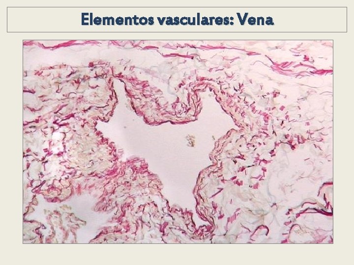 Elementos vasculares: Vena Elementos vasculares: Vena
