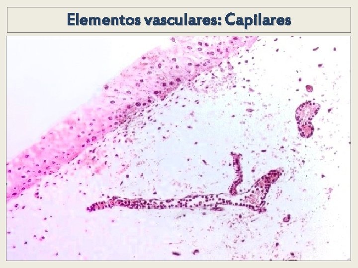 Elementos vasculares: Capilares Elementos vasculares: Capilares
