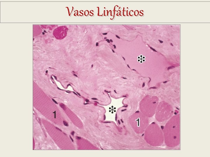 Vasos Linfáticos Vasos Linfáticos