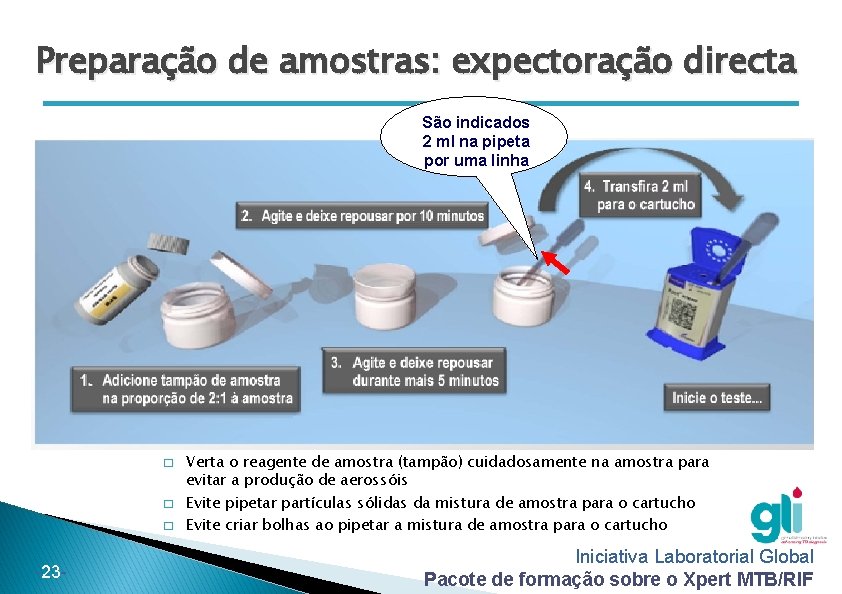 Preparação de amostras: expectoração directa São indicados 2 ml na pipeta por uma linha