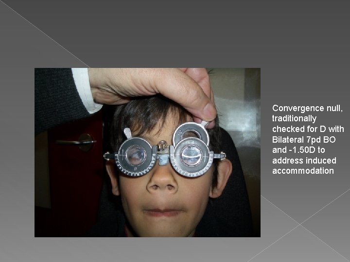 Convergence null, traditionally checked for D with Bilateral 7 pd BO and -1. 50