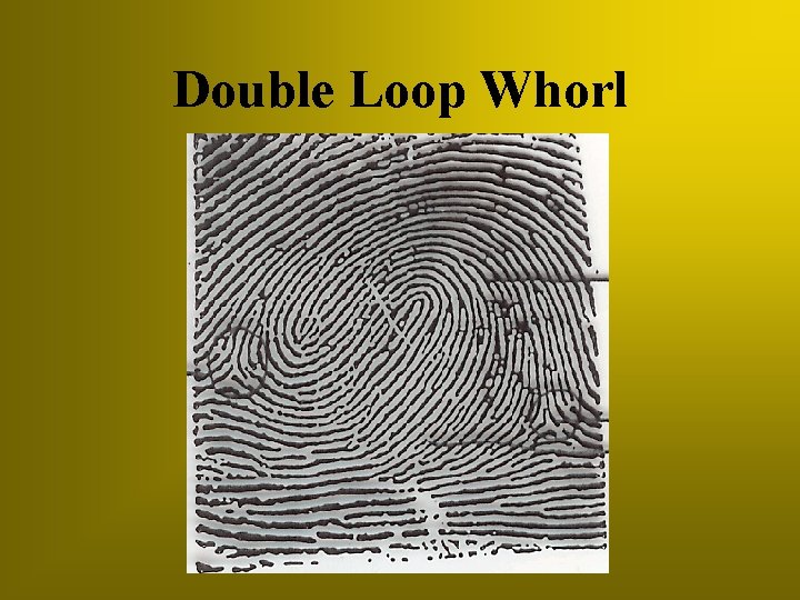 Double Loop Whorl 