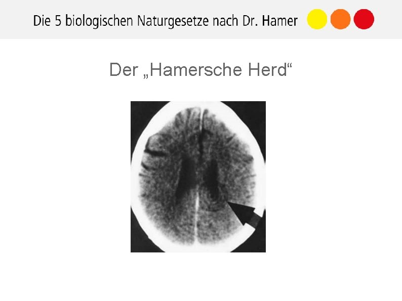 Der „Hamersche Herd“ 