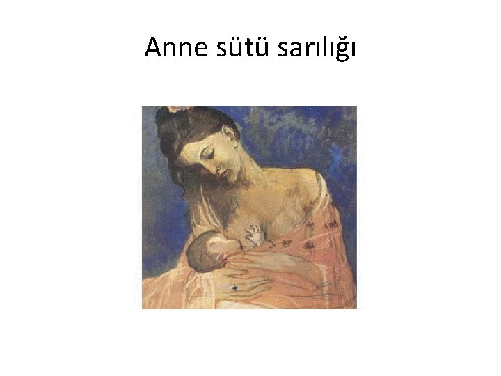 Anne sütü sarılığı 