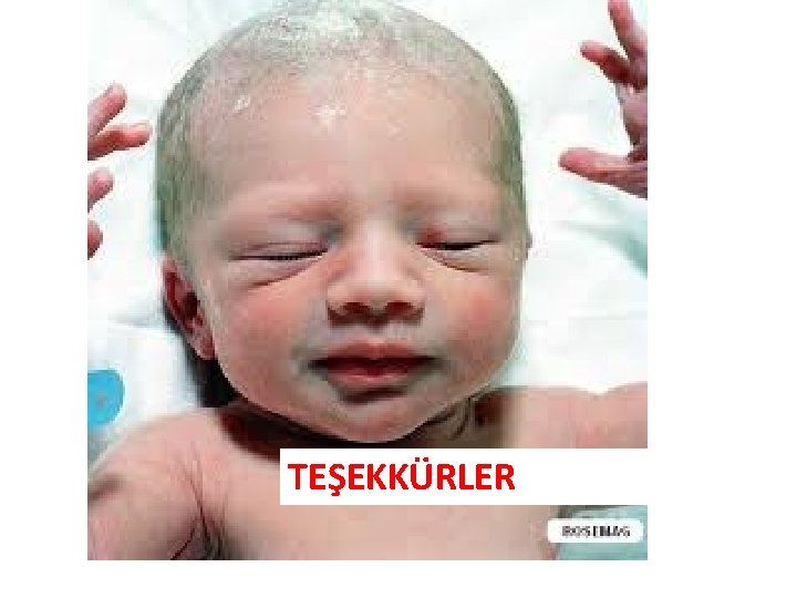 TEŞEKKÜRLER 