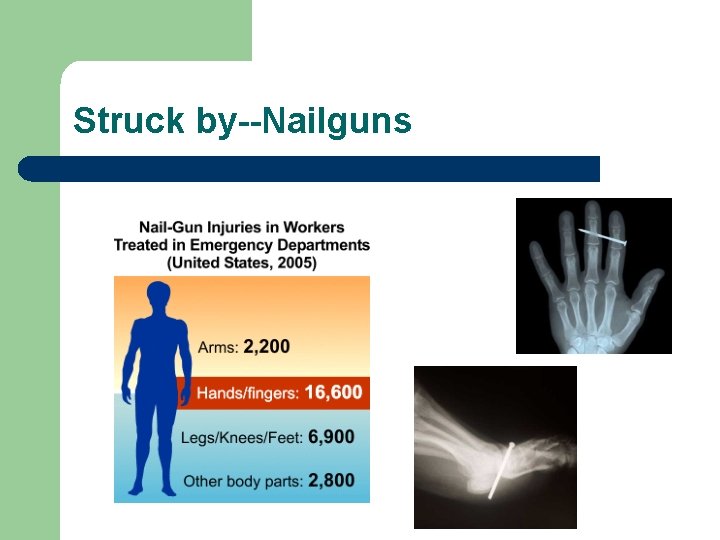 Struck by--Nailguns 