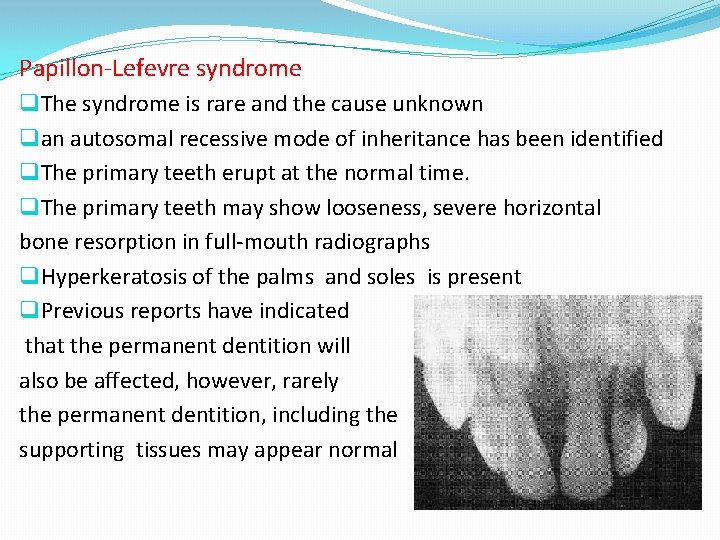 Papillon-Lefevre syndrome q The syndrome is rare and the cause unknown q an autosomal
