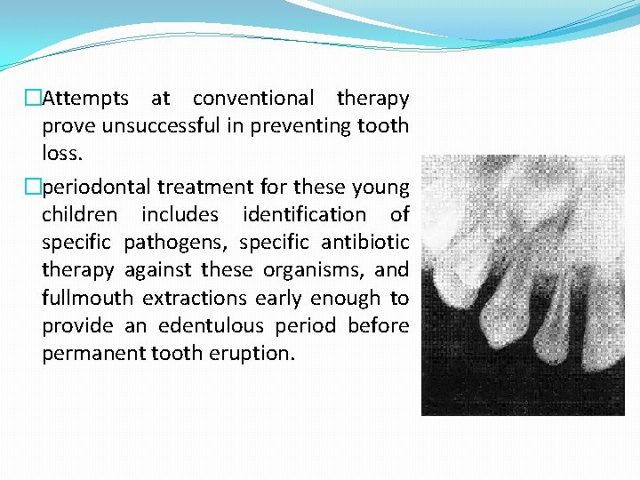 �Attempts at conventional therapy prove unsuccessful in preventing tooth loss. �periodontal treatment for these