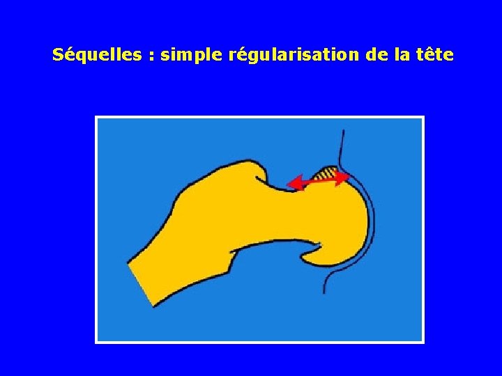 Séquelles : simple régularisation de la tête 