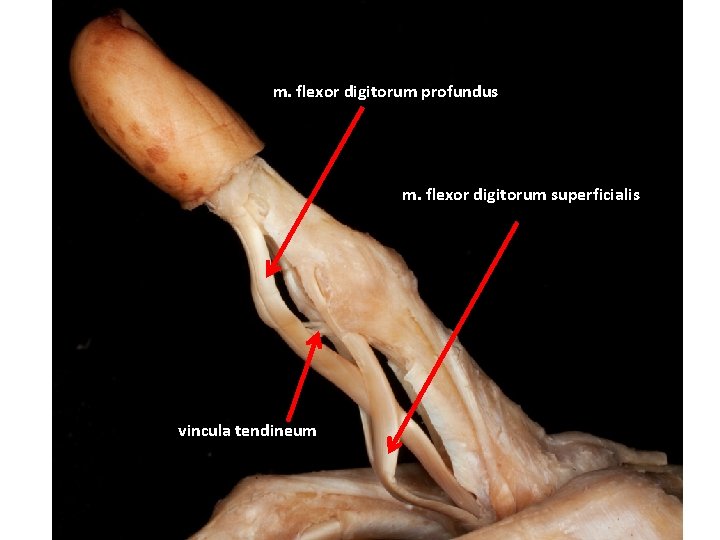 m. flexor digitorum profundus m. flexor digitorum superficialis vincula tendineum 